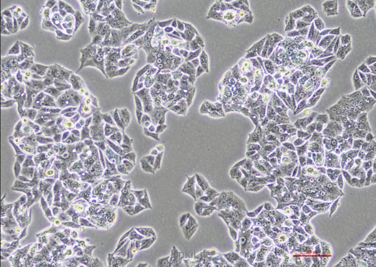 Human lung adenocarcinoma cell line NCI-H1395