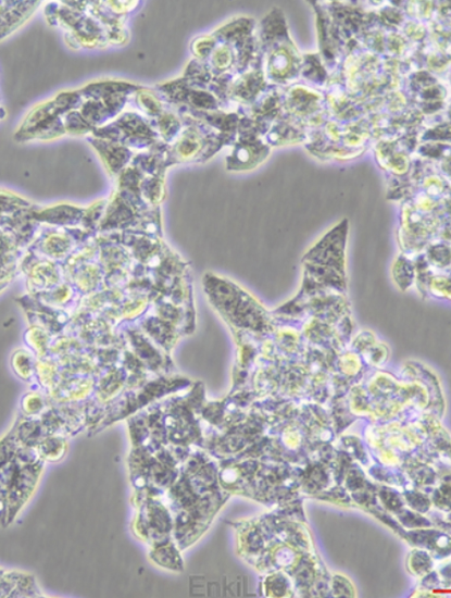 Human hepatocellular carcinoma cell HepG2