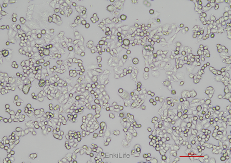 Human cervical cancer cell C-33A