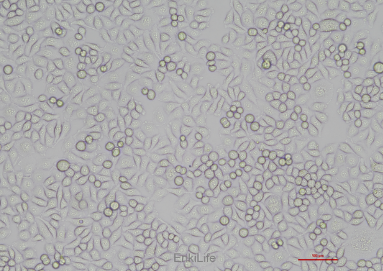 Human cervical cancer cell HeLa