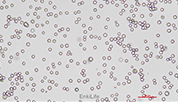 Human myelodysplastic syndrome cell line SKM-1
