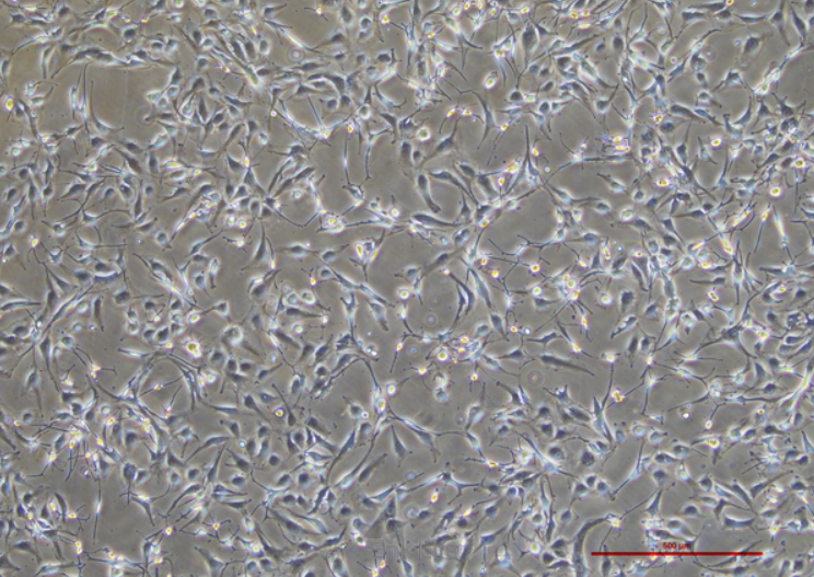 Human glioblastoma cell line A172
