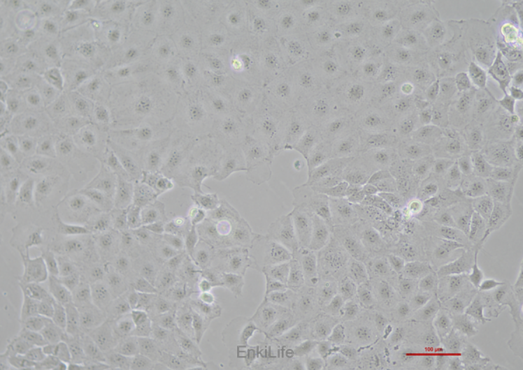 Caco-2 human colon cancer cells