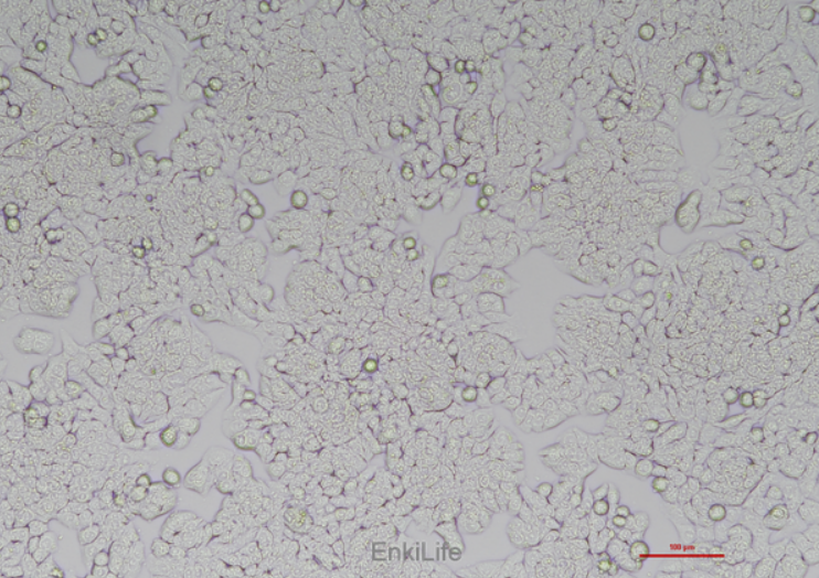 Human colon cancer cell line HT-29