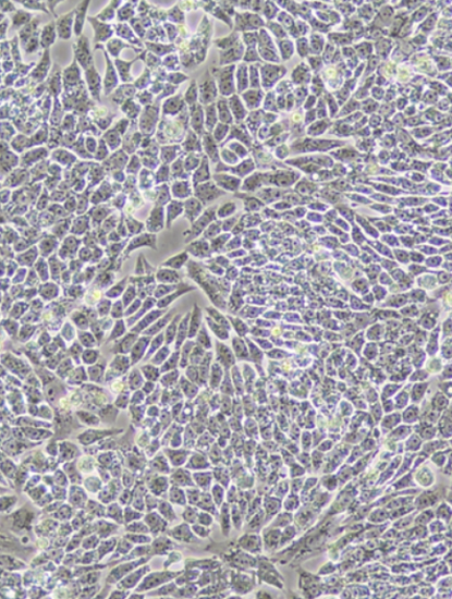 Human gastric cancer cells (undifferentiated) HGC-27