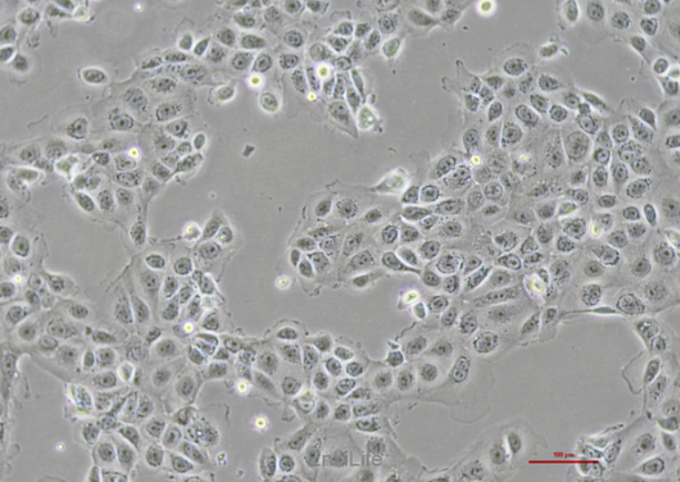 Human endometrial cells EEC