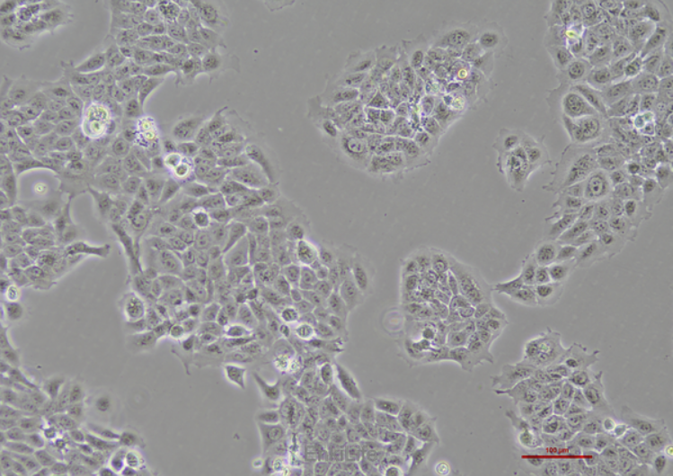 Human keratinocytes (HaCaT)