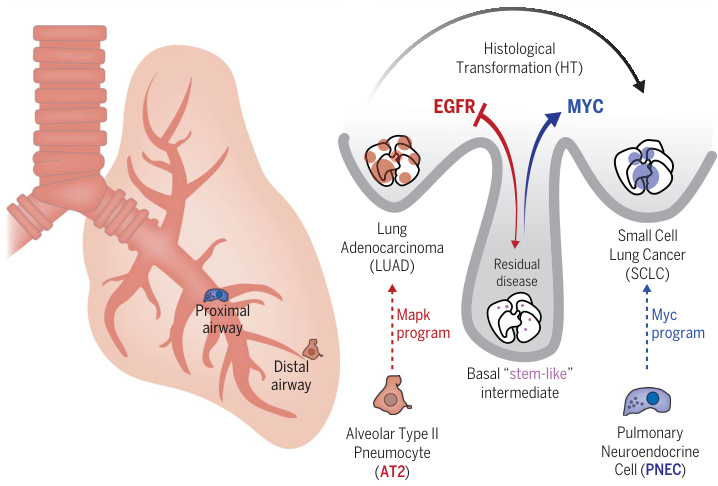 Lung Cancer Research（II）