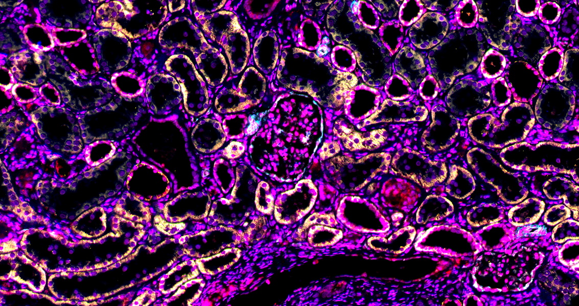 TSA multiplex fluorescence staining technology