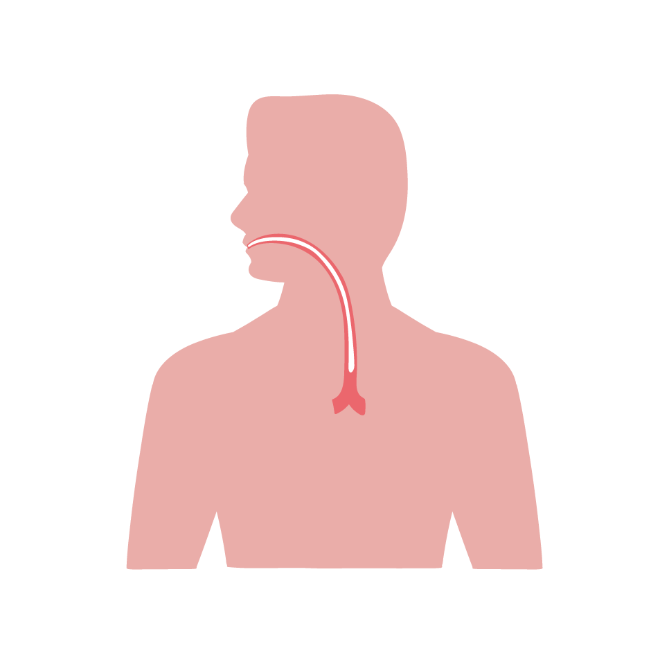 Esophageal Cancer