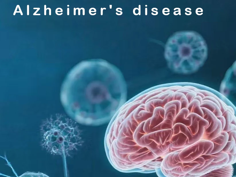  Alzheimer's disease (AD)