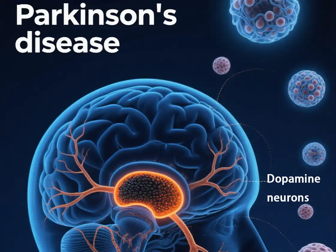 Parkinson's Disease (PD)