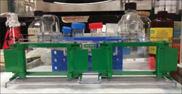 Western Blotting Protokolü Sorun Giderme: Proteinler için Jel Elektroforezi