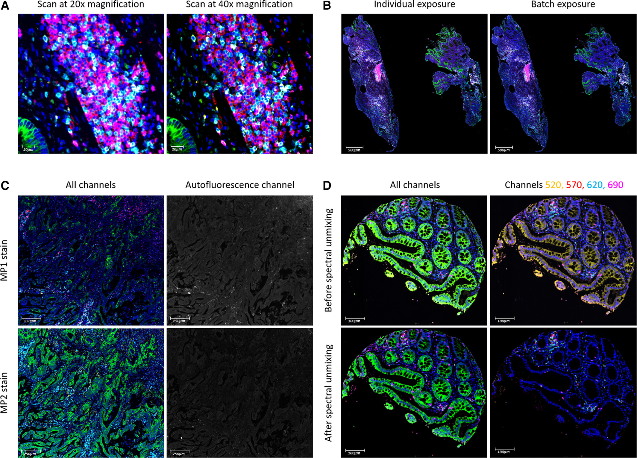Literature Sharing: Characterization of Tumor Immune Microenvironment by Multiplex Immunofluorescence