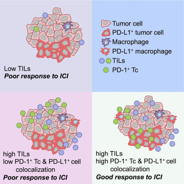 Literature Sharing: Multiplex Immunofluorescence for Early Breast Cancer ICI Therapeutic Efficacy Prediction