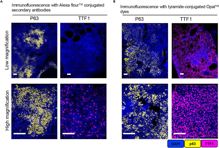 Literature Share: Multiplexed Fluorescent Staining of Pulmonary Tuberculosis Lesions Based on TSA