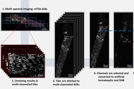 Literature Sharing: Assessment of Inflammatory Cell Infiltration in Kidney Transplant Biopsies Using Multiplex Immunofluorescence Technology