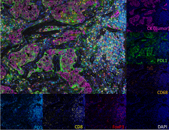 Literature Sharing: SITC Best Practices for Multiplex Immunohistochemistry and Immunofluorescence Staining and Validation