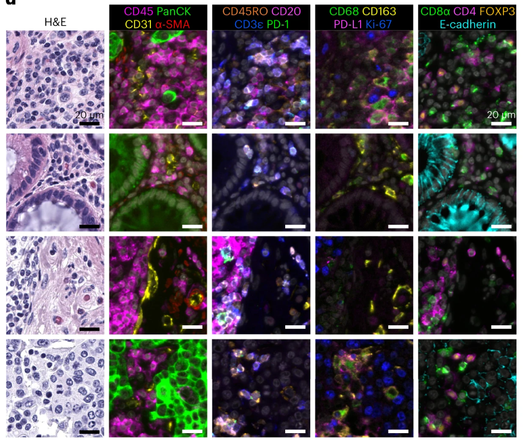 Literature Sharing: Combined Multiplex Immunofluorescence and Traditional Histology Imaging for Cancer Biomarker Discovery