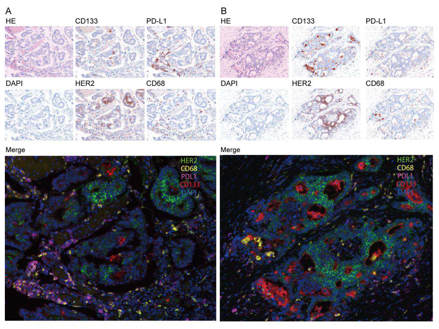Literature Sharing: Multiplex Fluorescence Immunotechnology Reveals Colorectal Cancer Biomarkers