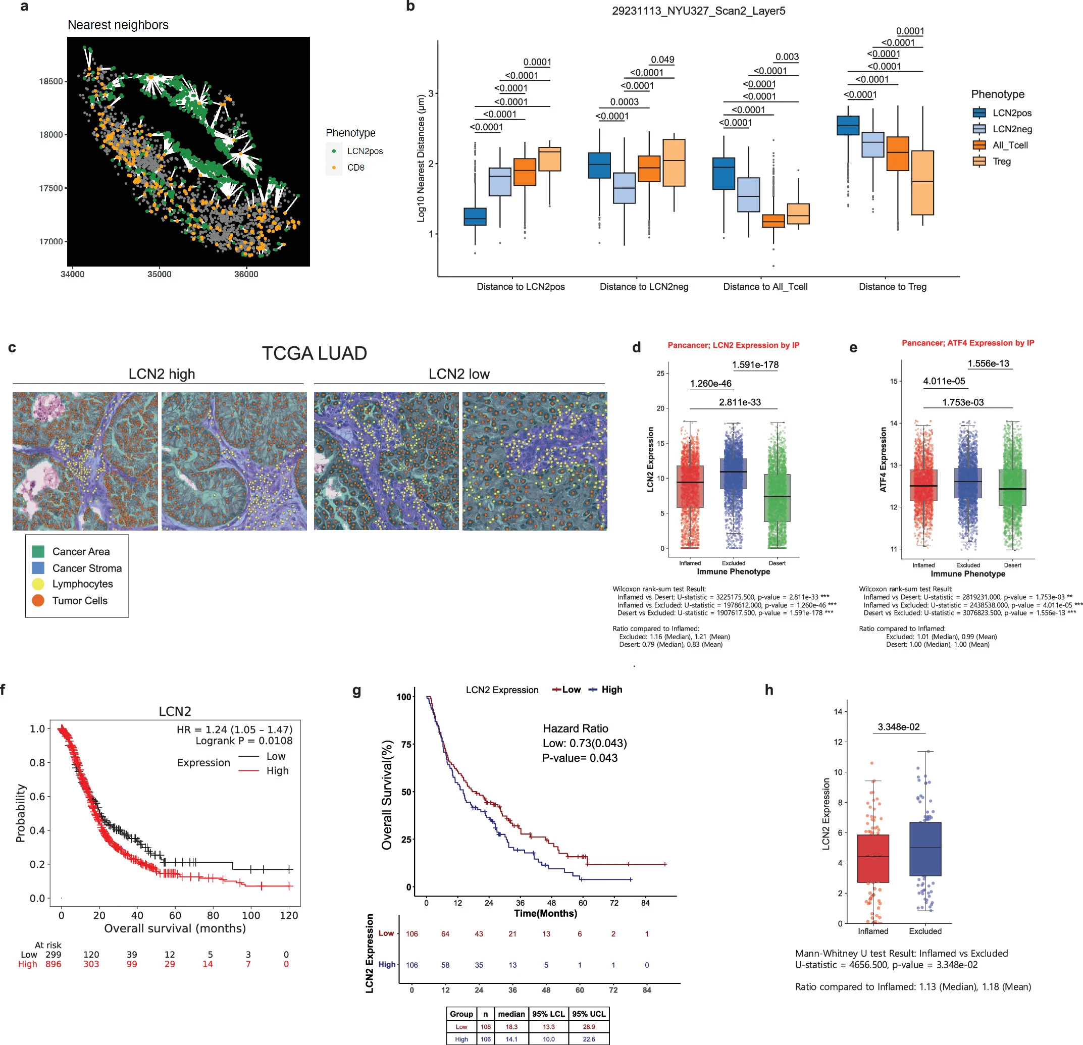 Literature Sharing: The Integrated Stress Response Mediates Tumor Immune Evasion via LCN2