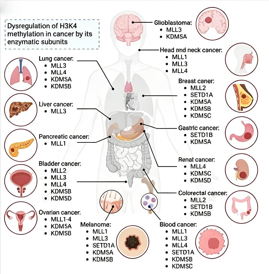 Alterations of genes involved in regulating the methylation of H3 lysine 4 (H3K4) in cancer