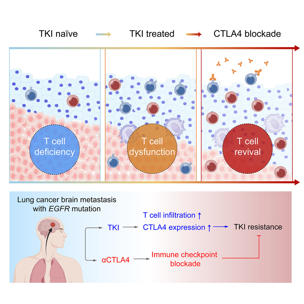 Literature Sharing: TKI Combined with CTLA4 Blockade: A Novel Mechanism Reshaping the Immune Microenvironment of Lung Adenocarcinoma Brain Metastasis