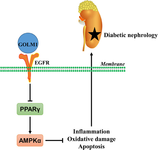Podocyte GOLM1: The 