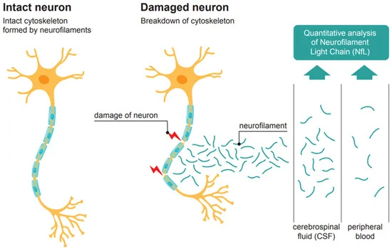 Neurofilaments: From Neuronal Cytoskeletal Scaffolds to Neurological Disease Biomarkers