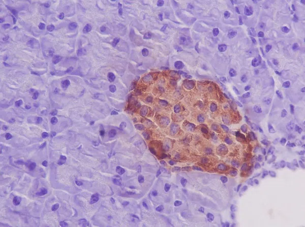 Pancreatic Marker IHC Antibody