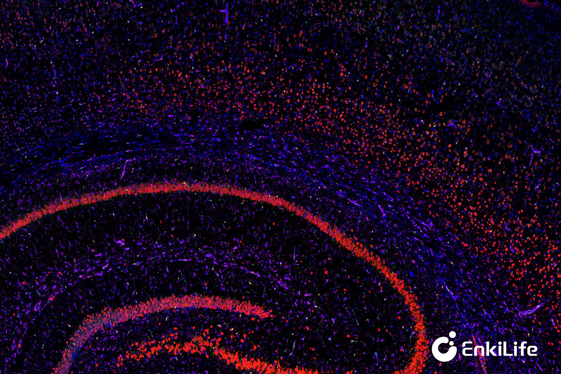 ​ Multiplex Immunofluorescence mIHC Kit
