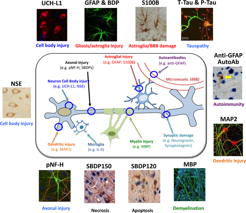 Traumatic Brain Injury Biomarker