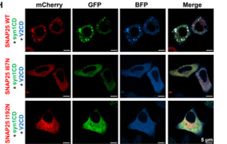 Tiny Condensates, Mastering Synaptic Communication: Literature Interpretation of SNAP25 LLPS Mechanism