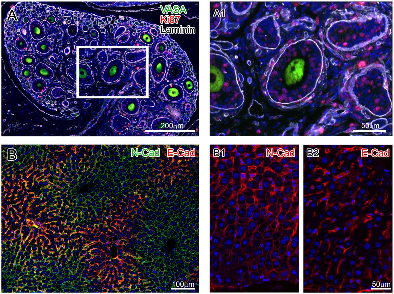 Visualizing Why TSA Technology Outperforms Traditional IHC/IF Through Experimental Images