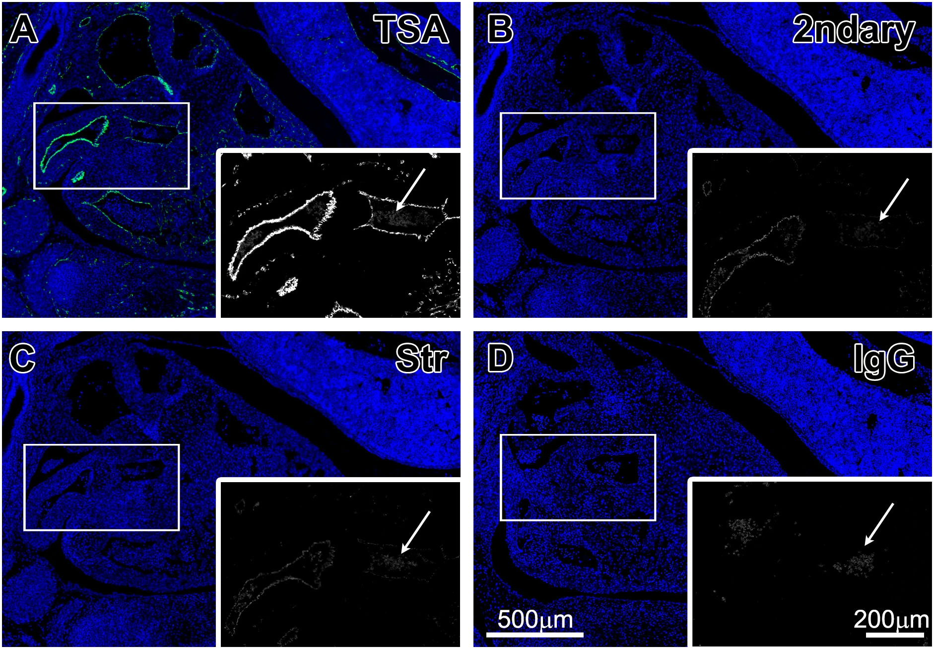 Functions, Markers, and mIHC Detection Protocols for 7 Core Cell Types in the Tumor Microenvironment