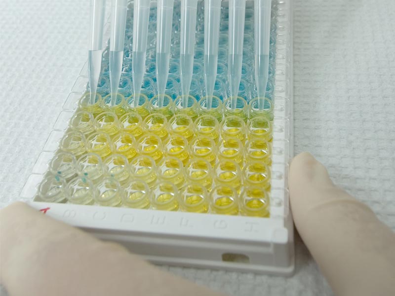 From Colorless to Blue to Yellow: The Scientific Principles Behind TMB Color Development Reaction