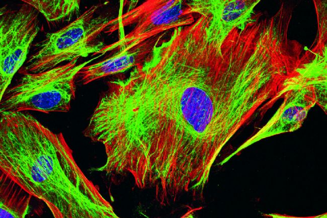Comprehensive Guide to Commonly Used Antibody Labeling Markers