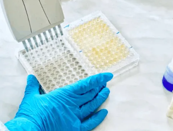 TMB Chromogenic Operation FAQs | ELISA