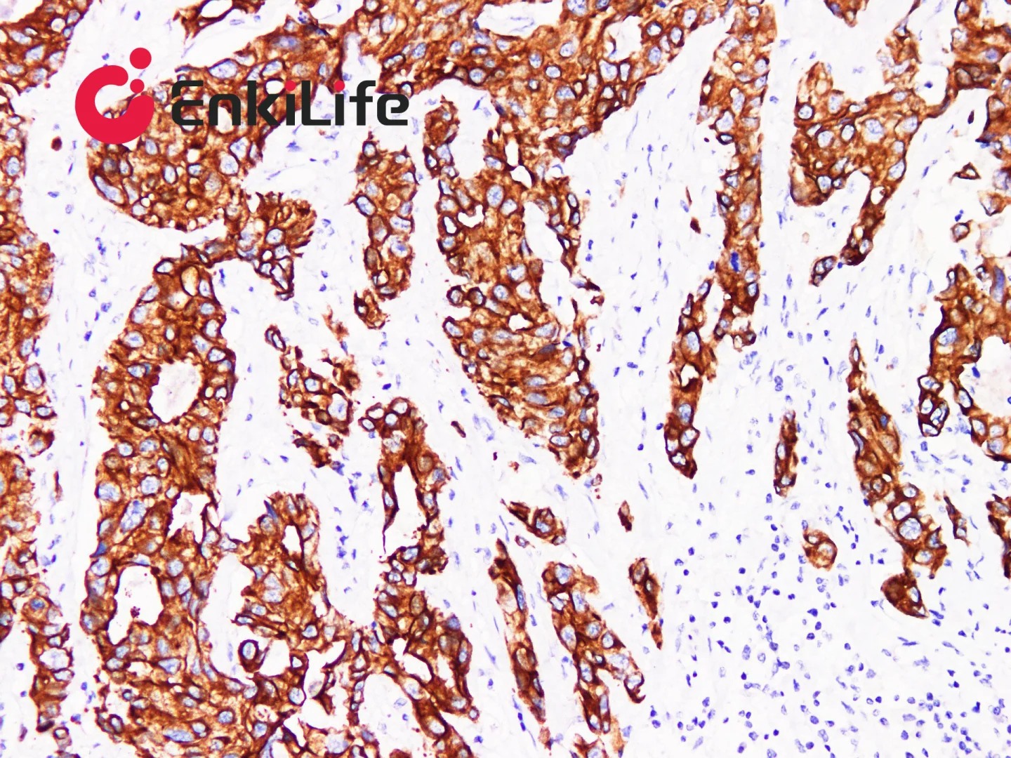 From Specific Recognition to Visualization Output: Detailed Explanation of IHC Signal Amplification System and Detection Technology