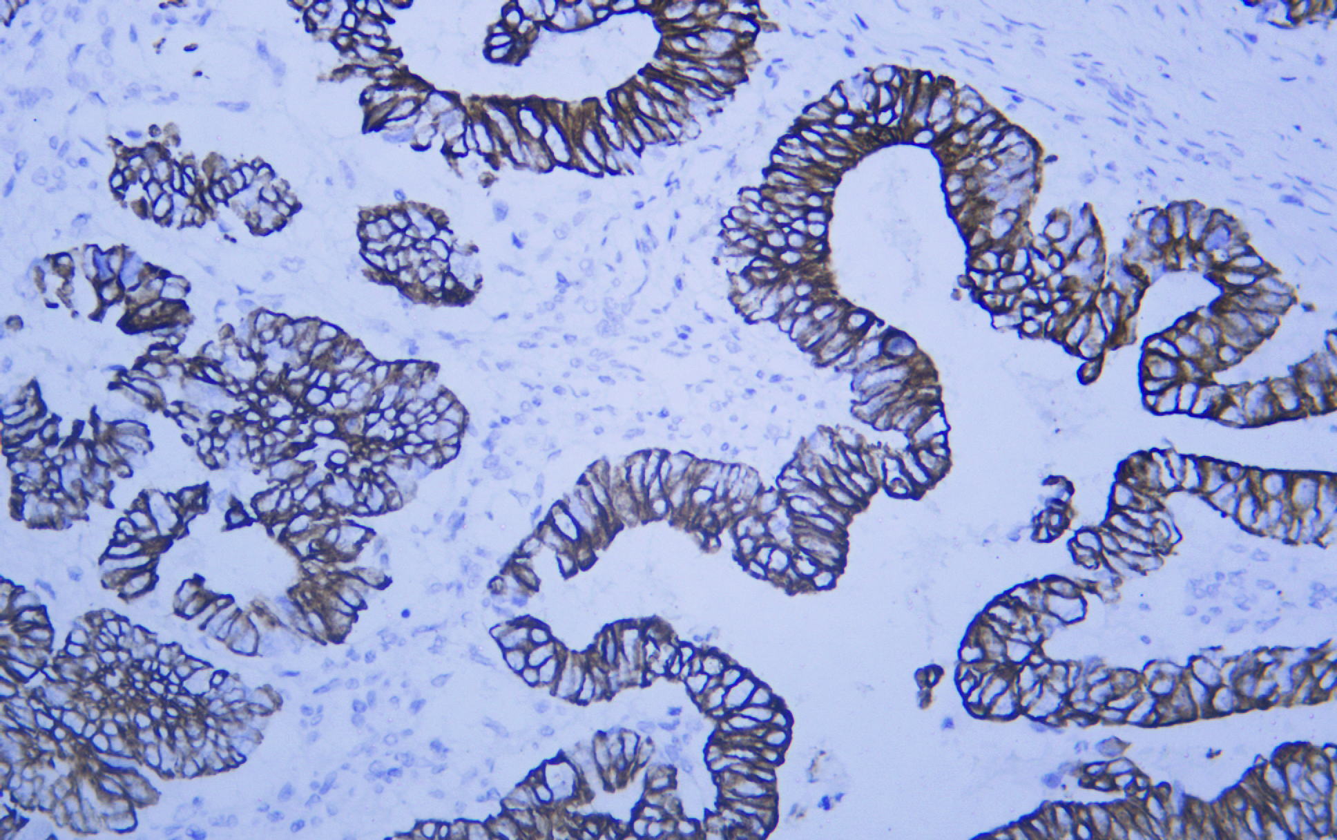 Cytokeratin Markers