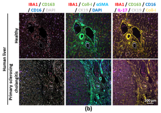 Literature Analysis: Deciphering Tissue Immune Microenvironment Based on Multiplex Fluorescence Immunostaining Technology
