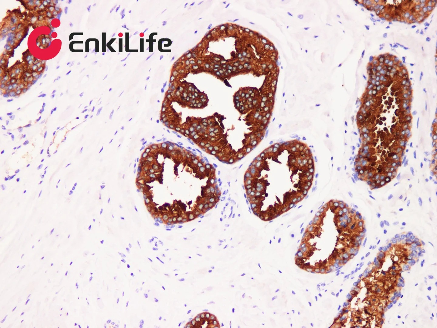 Comprehensive Guide to IHC Kit Selection | Basic HRP VS High-Sensitivity Polymer‑HRP
