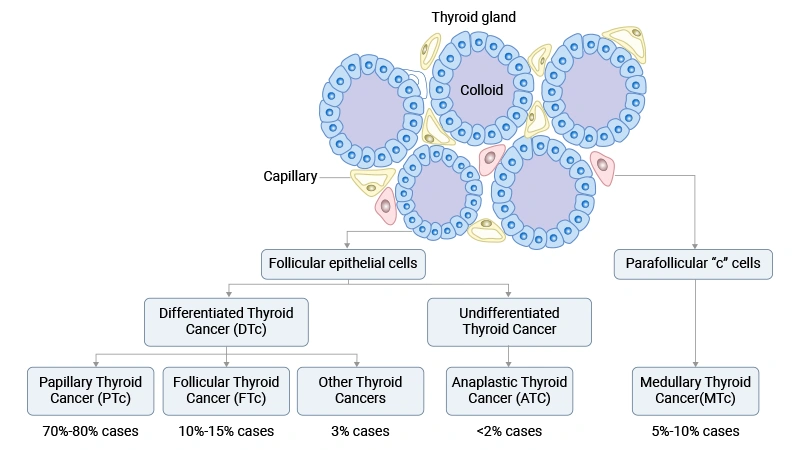 About Thyroid Tumor: Core Research Knowledge Overview