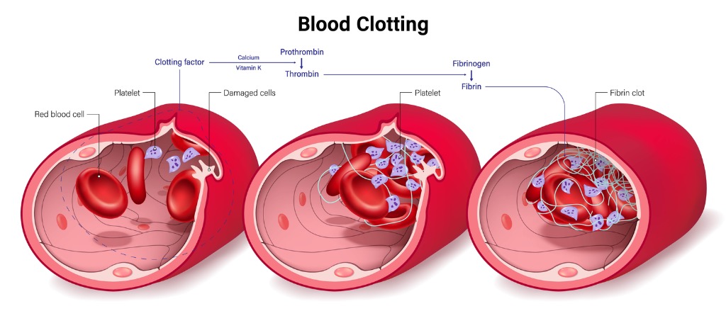 A Systematic Introduction to Coagulation: Factors, Cascade and Clinical Implications
