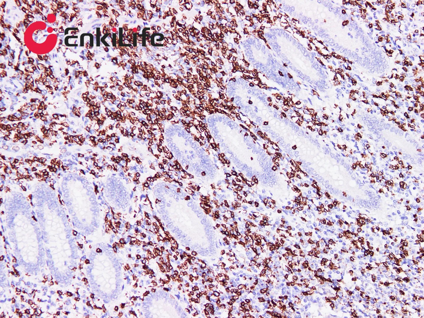 IHC Experiment Innovation: One-Step Integration of Deparaffinization and Antigen Retrieval, Unlocking a New Paradigm of Efficient and Safe Experiments