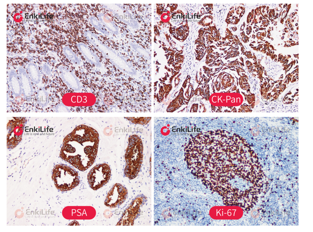 Precise Chromogenic Detection, Empowering Efficiency | EnkiLife IHC Detection Kits