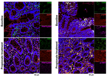 Sci Adv Latest Breakthrough: Unlocking a New Identity for Short-Chain Fatty Acids! p38α Acts as a Metabolite Antenna, Bringing New Dietary Intervention Ideas for Ulcerative Colitis