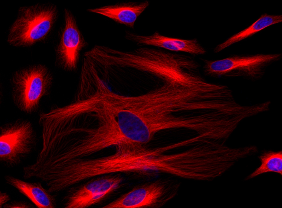 Antibody Labeling Kits: Unlocking the 