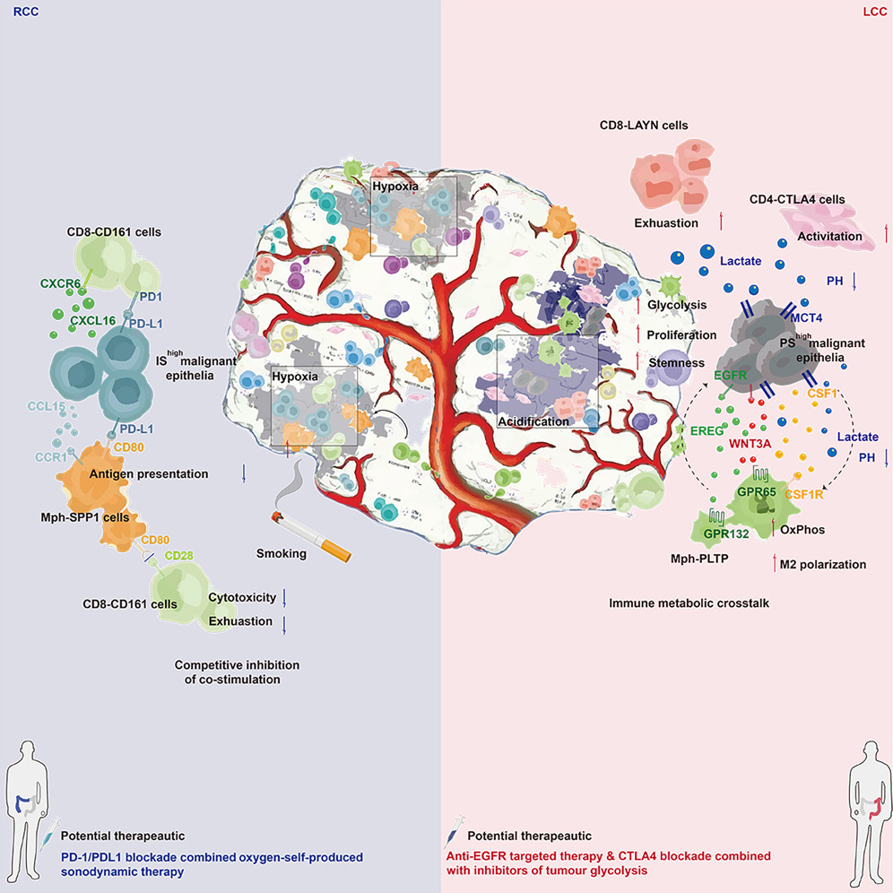 High-Score Literature Sharing: Differentiated Mechanisms and Intervention Strategies of Multicellular Immunosuppressive Hubs in Left- and Right-Sided Colon Cancer