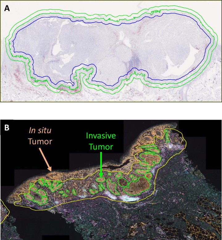 mIF/mIHC Image Analysis: Mining In‑situ Tissue Immune Information